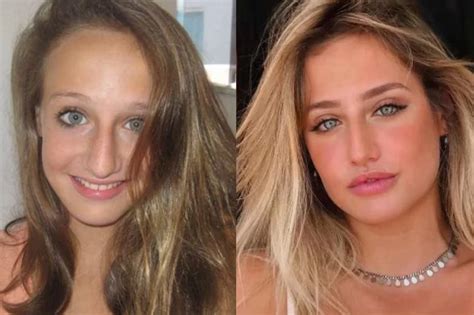 bruna griphao antes da cirurgia|Antes e depois de Bruna Griphao, participante do。